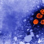 Esta imagen de microscopio de electrones de 1981 publicada por los Centros de Control y Prevención de Enfermedades de Estados Unidos mientras partículas del virus de la hepatitis B, indicadas en naranja. (Dr. Erskine Palmer/CDC via AP, Archivo)