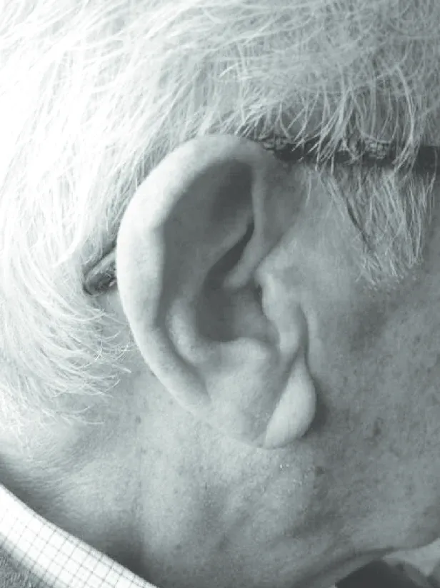 oreja con signo de frank