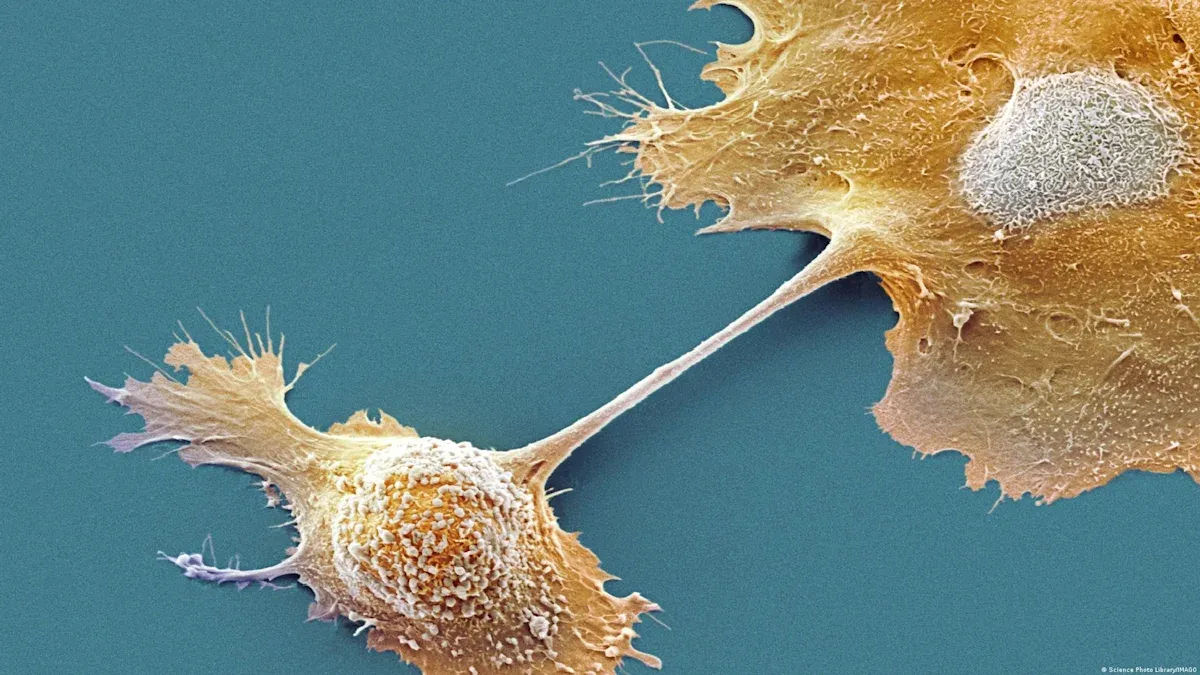 Perú: operan con éxito a una mujer con los órganos invertidos para extirparle un tumor pancreático